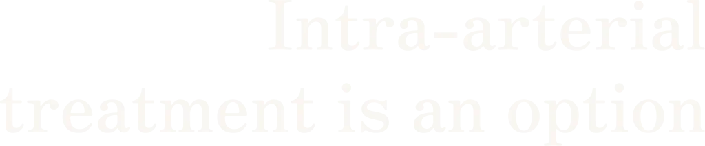 Intra-arterial treatment is an option
