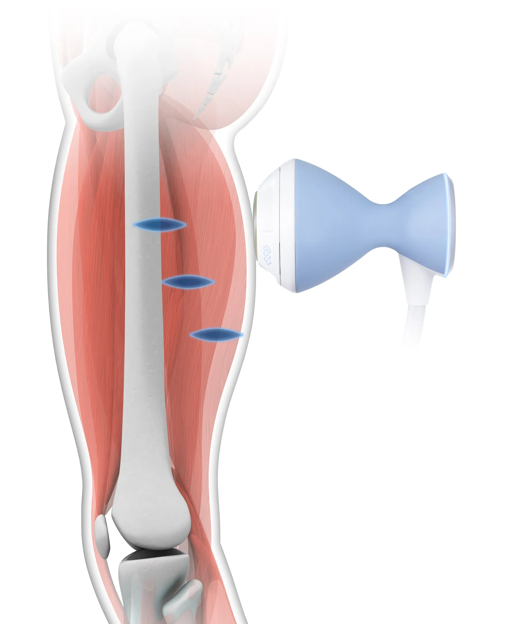 拡散型・集束型について