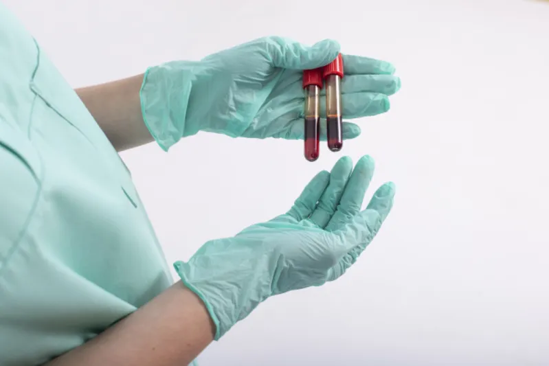 再生医療（PFC-FD™療法）とは